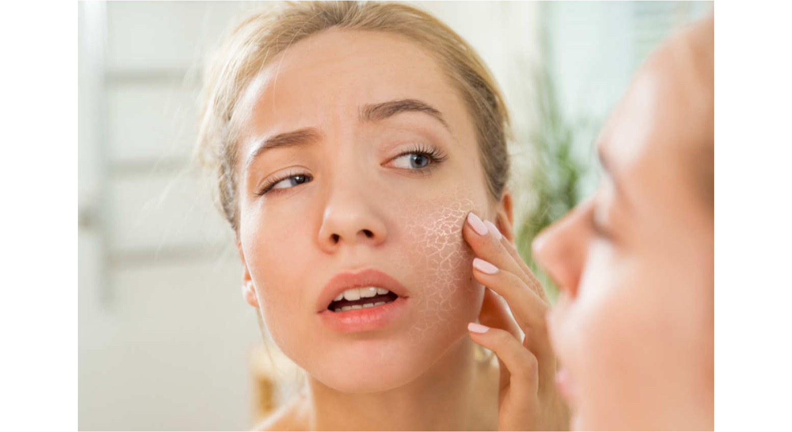 Pelle Secca su viso e gambe: 20 rimedi naturali efficaci