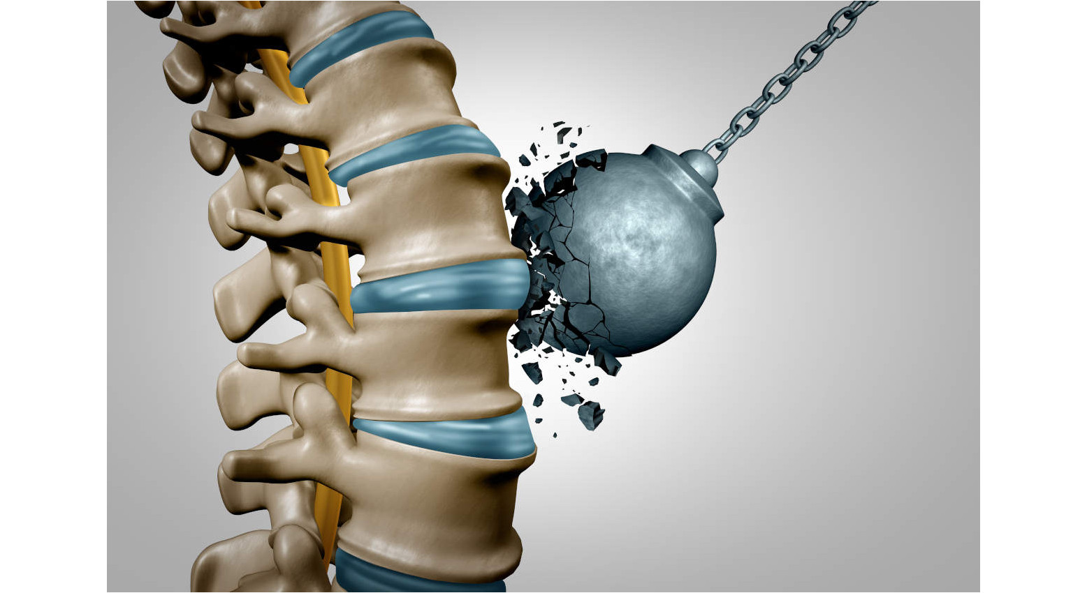 Vitamine per le ossa: quali sono e perché integrarle