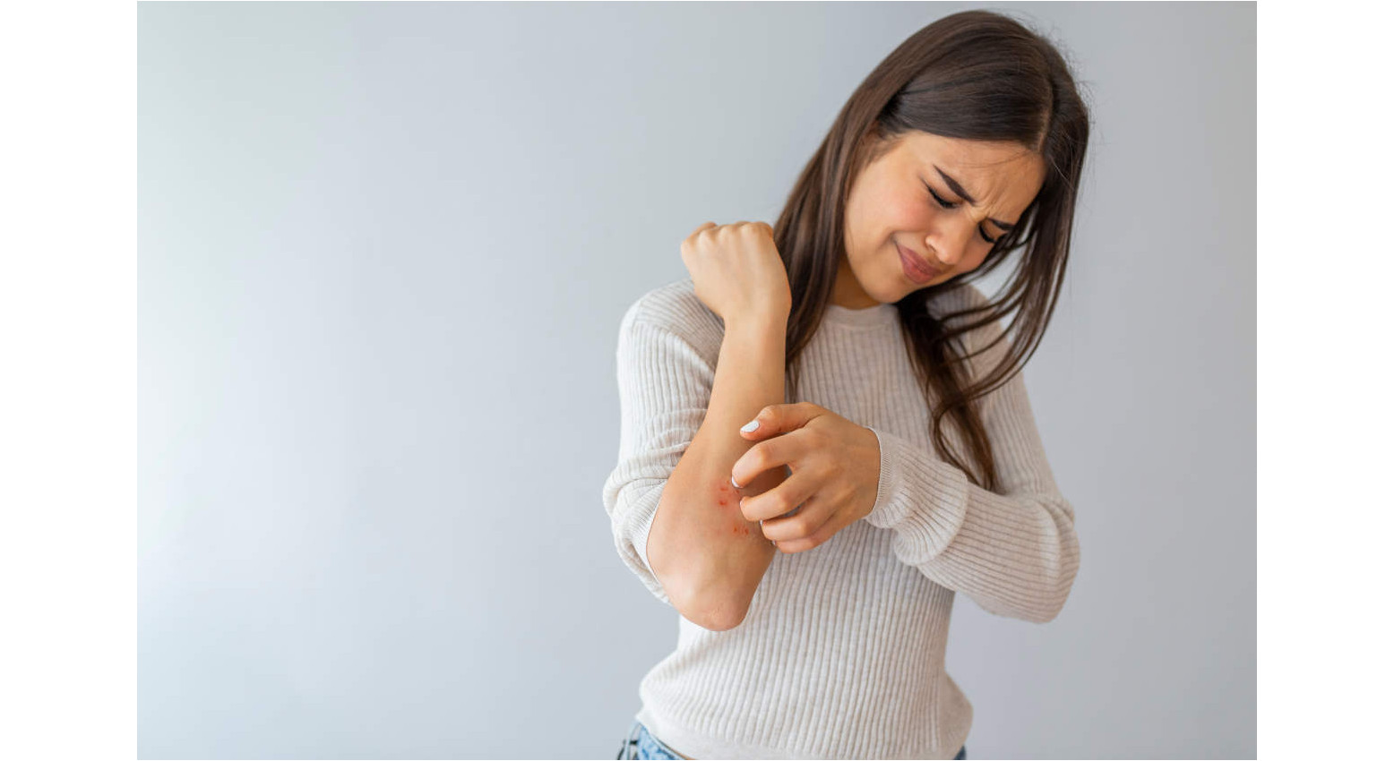 Dermatite Atopica: i 15 migliori rimedi naturali